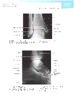 Sobotta  Atlas of Human Anatomy  Trunk, Viscera,Lower Limb Volume2 2006, page 312